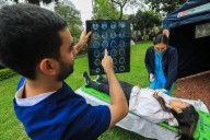 Una de cada 4 personas podría tener un ACV en su vida ¿Quién corre mayor peligro?