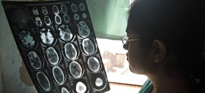 Más de once millones de personas mueren cada año por trastornos neurológicos