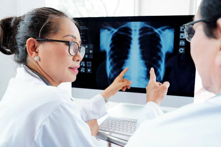 CHEST: SGLT2 Inhibitors May Slow Nodule Growth in Pulmonary Malignancies