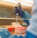 Thyrocare Technologies Share Price Surging In Trade On Back Of Stellar Q2
