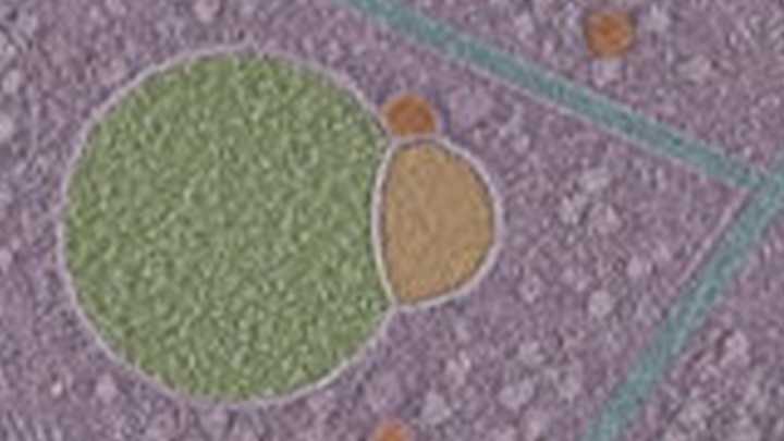 Scientists discover never-before-seen 'snowman wearing scarf' in human cells