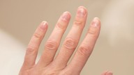 Rayas, manchas o líneas en las uñas: el detalle que muchos ignoran y dice mucho de tu salud