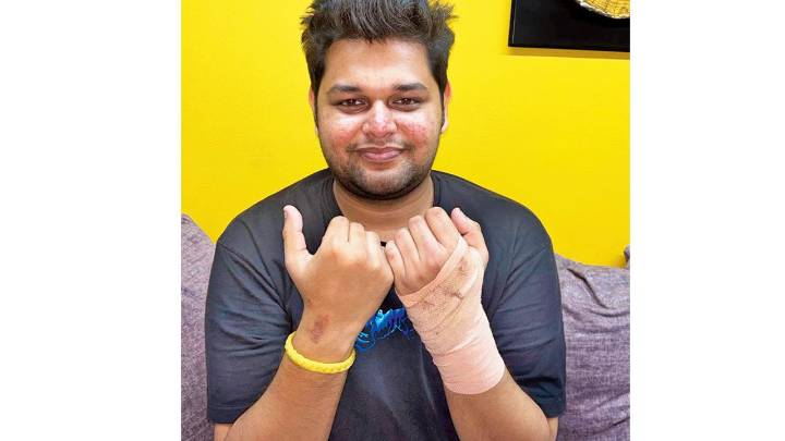 Blazes turn festive night grim in Mumbai; 24-year-old man emerges as Diwali hero