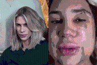 Muere influencer en Brasil tras cirugía estética en los ojos; lo habría operado un dentista