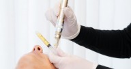 A ‘vampire facial’ might sound spooky, but results are anything but