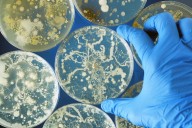 2019 to 2023 Saw Increase in NDM-Carbapenem-Resistant Enterobacterales