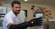 'The NHS gave me the world's most advanced bionic arm