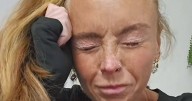 'I beat cervical cancer but my life spiralled after doctors gave me painkillers'