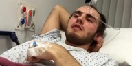 Un youtuber vivió 12 años con síntomas muy dolorosos, los médicos hablaban de estrés, pero un video que encontró de causalidad le cambió la vida