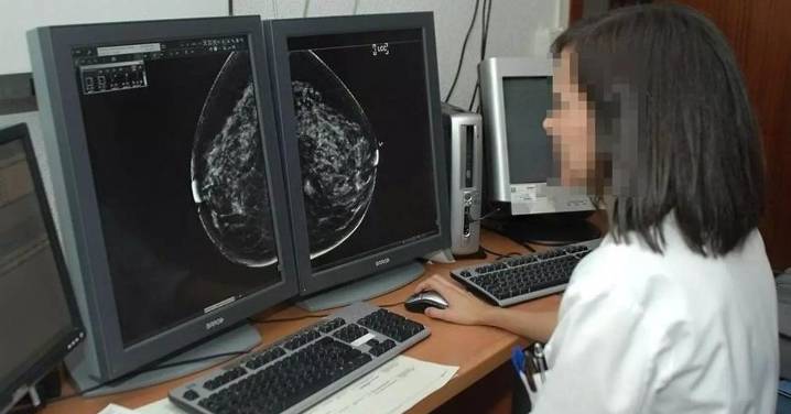La Asociación Española Contra el Cáncer ante los problemas de cribado:  "No tenemos información sobre el alcance"
