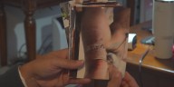 Victims speak out after dog attack