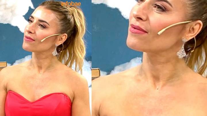 Mariana Brey dio una nota con moretones en su cuello y generó preocupación