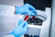 Un análisis genético de una muestra de sangre podría detectar el párkinson antes de los primeros síntomas