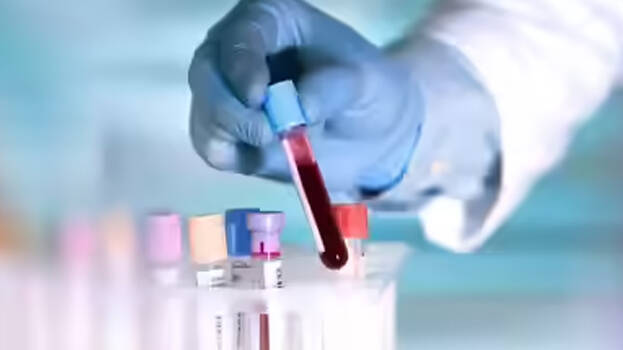 Five children test HIV positive after transfusion from blood bank; health department intensifies probe