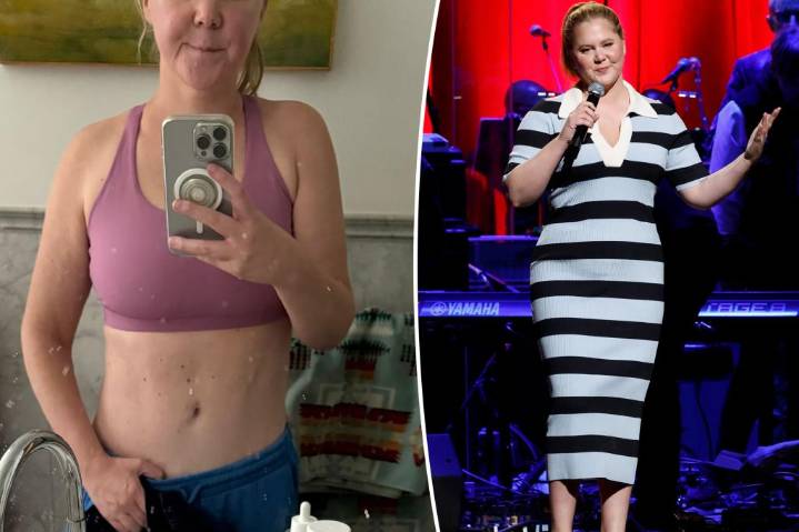 Amy Schumer flaunts toned stomach after Mounjaro use: 'No filter'