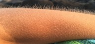¿Por qué se nos eriza la piel al escuchar una canción?