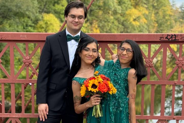 Conjoined Twin Carmen Andrade Celebrates 1st Wedding Anniversary with Husband