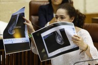 La Fiscalía de Andalucía abre diligencias sobre los fallos en el cribado del cáncer de mama en Andalucía