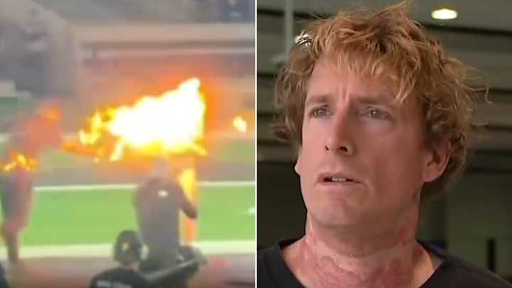 Prankster badly burned in stunt gone wrong at Nitro Circus show at Marvel Stadium