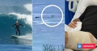 Surfista sufrió "aterrador" ataque de tiburón y se defendió a los puños: necesitó 50 puntos de sutura