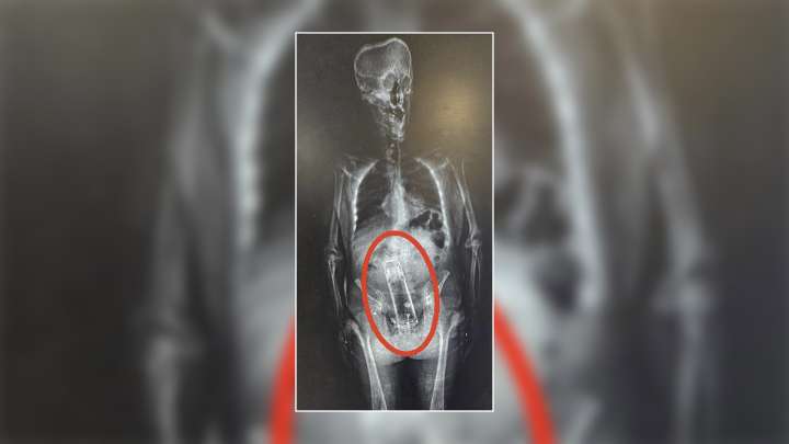 Walter Frymire had thermos hidden in body during arrest: Sheriff