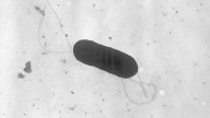 Listeria outbreak linked to ready-to-eat pasta meals leaves 2 more dead, 7 sickened