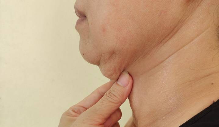 El grosor del cuello puede indicar mucho sobre tu salud