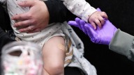 Public health experts worry about the proposal to split the MMR vaccine. A doctor explains why