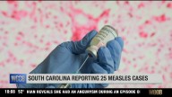South Carolina reporting 25 measles cases