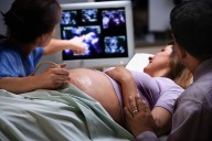 At what age is it morally permissible to kill the unborn?