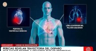 Caso Eduardo Ruiz: Revelan que proyectil habría ingresado tras un rebote, según pericia