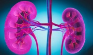 FDA Approves Obinutuzumab for Active Lupus Nephritis