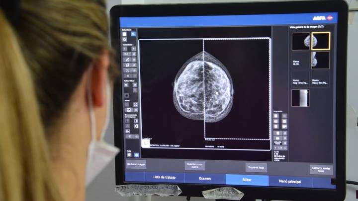 En PBA las mamografías se indicarán desde los 40