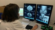 A prevención e a detección precoz, claves do Día Mundial do Cancro de Mama