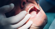 Exactly who may qualify for free NHS dental appointments and treatments