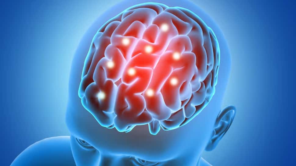 Rising Brain Stroke Cases In India: Experts Reveal How Lack Of Sleep And Stress Are Putting Even Young Adults At Risk