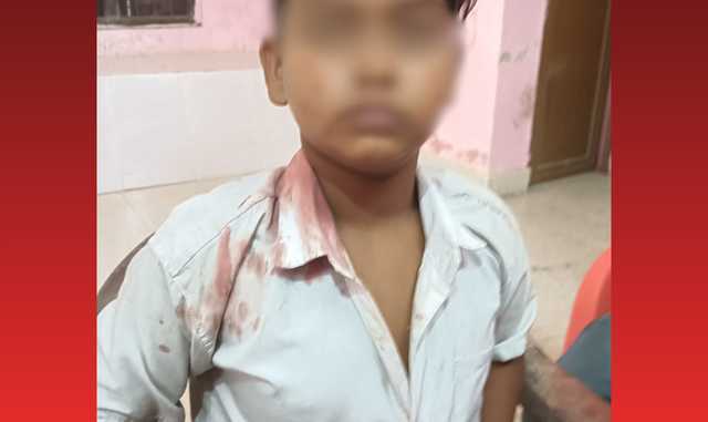 Class 4 Student Brutally Beaten Up by Headmaster in Bolangir School
