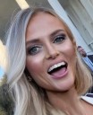 The incredible disappearing black eye of Katie Daviscourt