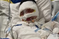 19-Year-Old Man Set on Fire amid Alleged ‘Ongoing Feud’