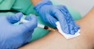 Piojos de la cabeza: cuáles son los síntomas de esta patología para detectarla a tiempo