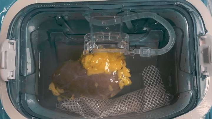 Enzyme tech for universal donor organs clears first human test