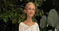 Muere Karolina Krzyzak a los 27 años, influencer que seguía una dieta frugívora: ¿Quién fue y en qué consistía su alimentación?
