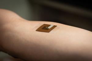 Wearable ‘smart’ patch can detect early signs of skin cancer