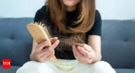 Oral minoxidil: The affordable hair loss solution you didn't know you needed