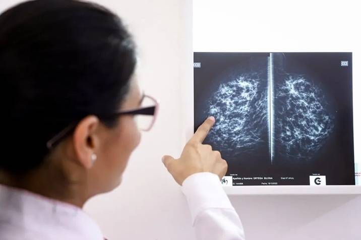 Medidas a tomar para reducir el riesgo de cáncer de mama