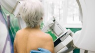 Llega un avance ante el cáncer de mama para más de 3.000 mujeres al año en España