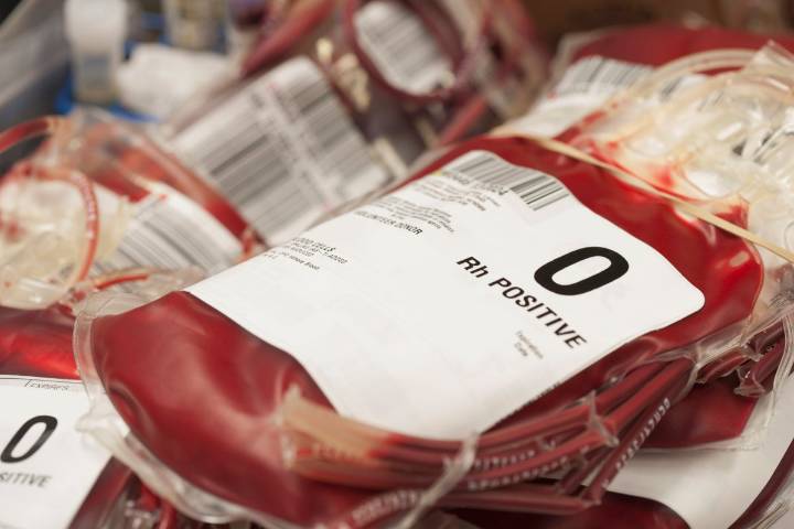 First-of-Its-Kind Kidney Transplant Could Lead to More Cross