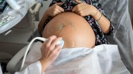 El 17 % de los 480 ginecólogos de la sanidad pública valenciana son objetores frente al aborto