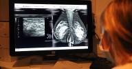El Defensor del Pueblo Andaluz investigará de oficio los fallos en el cribado del cáncer de mama