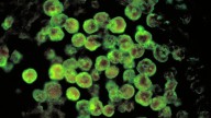 Amoebic infection confirmed in three-year-old boy in Kerala’s Kannur